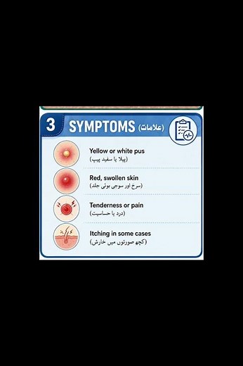 Pustule (Pus-Filled Skin Bump) | Causes, Symptoms & Prevention |