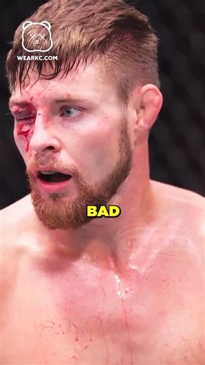 Overdogs USA on Instagram: "That time @thugnasty_ufc used his southern drawl to persuade the female eye doctor to let him continue the fight. 💀"