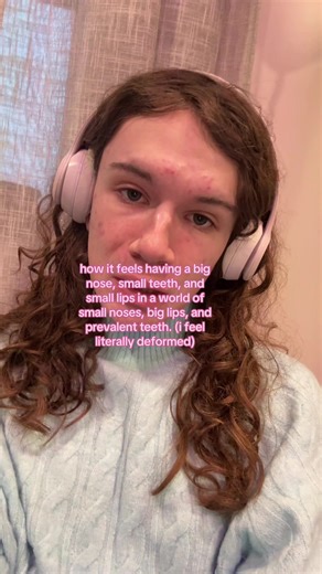 Understanding Facial Dysmorphia and Self-Perception