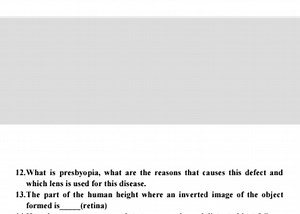 12. What is presbyopia, what are the reasons that causes this d... | Filo