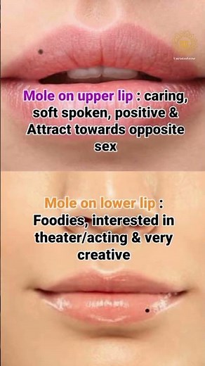 Luckiest mole on your body parts and their meaning⚫✨ #mole