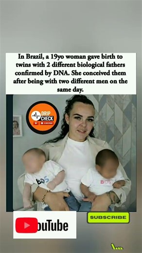 🇧🇷👶🏽👶🏻Brazilianwoman has twins with two different fathers,both conceived on the same day#shorts#fyp"