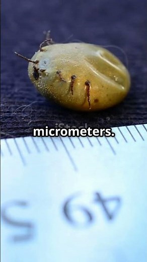 Tiny Wasp vs Amoeba Size Comparison Shock!