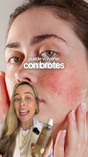 Do you have oily or sensitive skin and don't know what to use without irritating it?