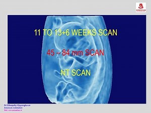 11 to 14 weeks scan- Guidelines & Protocol