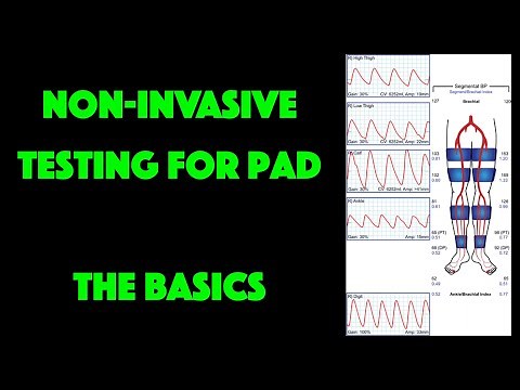 Non-Invasive Testing for Peripheral Artery Disease