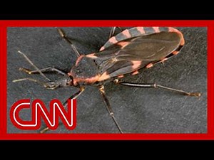 'Kissing bug' disease now considered endemic in the US