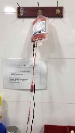 Blood donation Part 3 #blood #bloodgroup #bloodtyping #reagent #tests #lab #laboratory #donation #donate #donor #bloodbank #blooddonation #labtest #CBC #tubes #chemistrytest #explorepage✨ #fyp #explore #bleeding #مختبر #مختبرات_طبية #تبرع #متبرع #تحاليل
