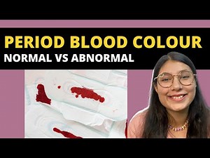 Period blood colours | Is my period blood colour normal? | Explains Chitra Singh