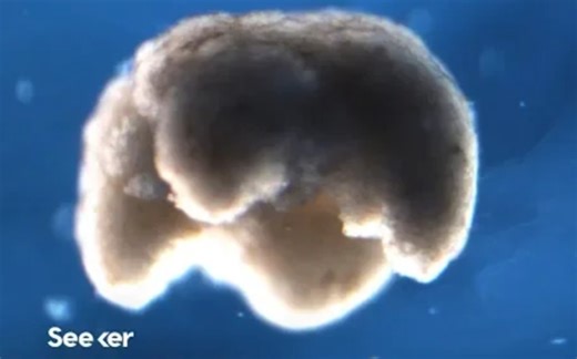 【细胞重组】Xenobots - 世界上首个活体机器人