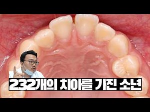 232개, 526개의 치아를 가졌던 소년. (치아종 이야기)