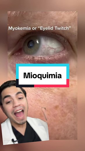 ¿Por qué te tiritan los ojos? Descubre la mioquimia y cómo solucionarla