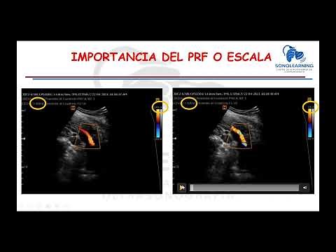 ¿QUÉ ES EL PRF? - FRECUENCIA DE REPETICION DE PULSOS
