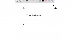 A patient presents at the clinic with an acute viral infection. Assays that analyze the viral life cycle classify the virus into Group V with a segmented genome. Which virus is the most likely diagnosis for the patient? a. Rabies virus b. Picornavirus c. HIV-1 d. Influenza A virus | Numerade