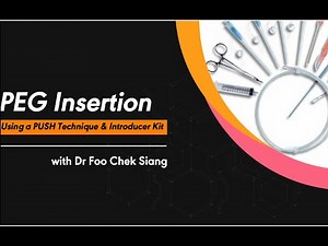 PEG InsertionUsing a PUSH Technique & Introducer Kit with Dr Foo Chek Siang