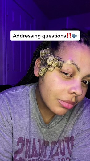 Pt 2 ✨ #rarediseaseawareness #trending #thegirlwiththemark #viral #fypシ #foryou #fyp #momsoftiktok