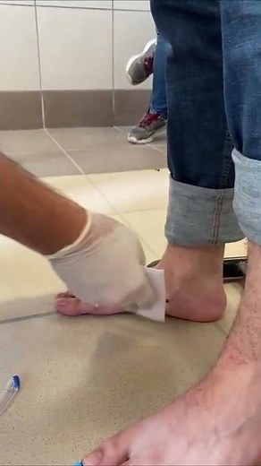 Navicular Drop Test | Ankle