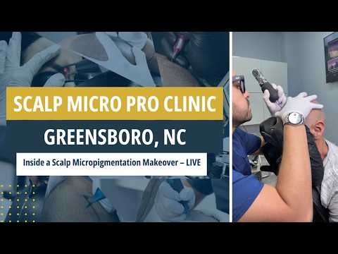 Inside a Scalp Micropigmentation Makeover – LIVE | Scalp Micro Pro Clinic