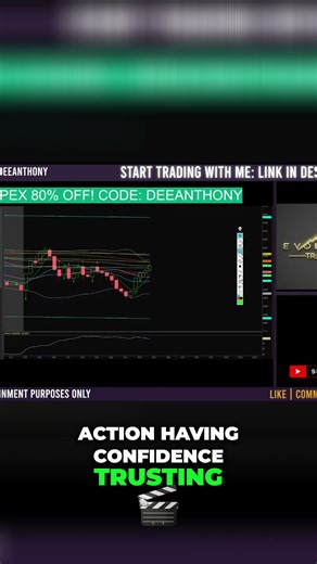 Scalping Strategy: Mastering Levels, Supply & Demand #shorts