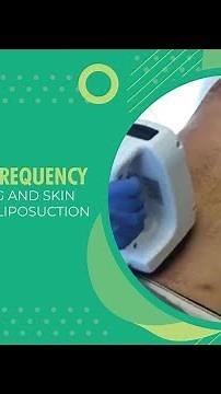 BodyFX Radiofrequency Body Contouring and Skin Tightening Post-Liposuction | Live