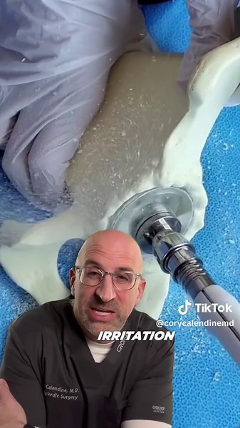 Bone Shaving Mess in Hip Replacement