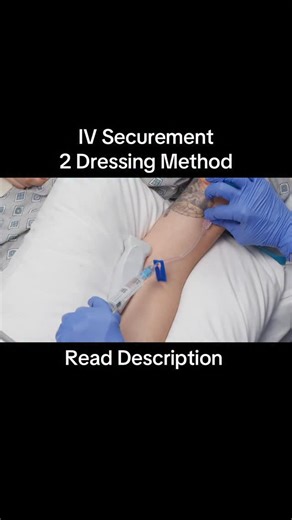 Brian “The IV Guy” on Instagram: "This is a short clip from one of the demos in the Ultrasound IV Insertion video course. The woman I hired to help with the course, who has over 20 years experience with ultrasound and IV insertion says this is her preferred method. . She simply uses 2 transparent dressings, one to cover the site and hub, and the other to secure the tubing. This secures the IV in such a way that prevents movement of the catheter while accessing the needleless connector, and has s
