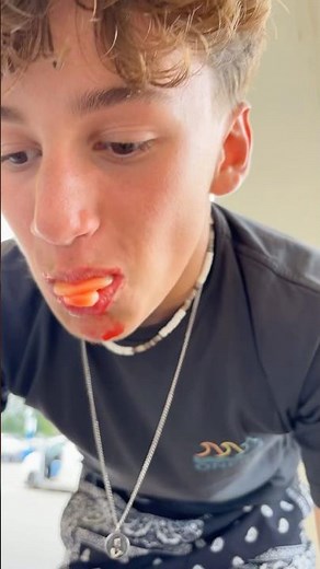 Belfi force feeding part 1