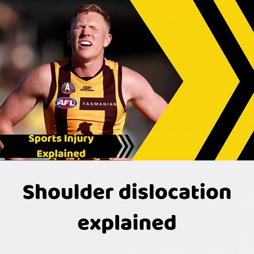 James Sicily Shoulder Dislocation: Causes, Injuries, and Treatment