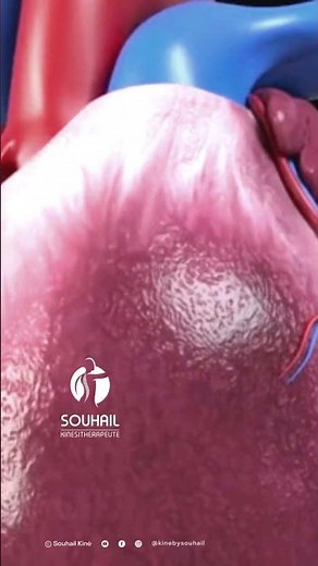 Open Heart Heart Surgery ╭❤️～ Heart Bypass || 3D Medical Animation
