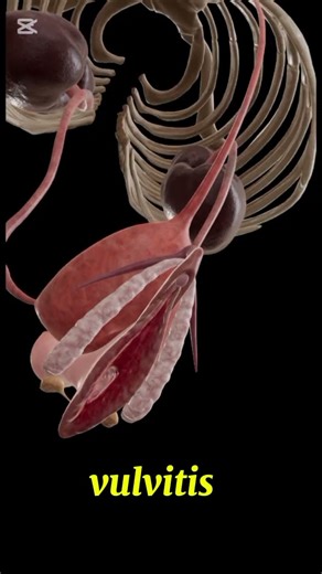 vulvitis#gynecology#1millionviews#3danimation#viralvideo