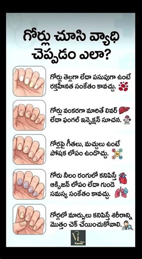 గోర్లు చెప్పే ఆరోగ్య రహస్యాలు: వ్యాధులను ముందే పసిగట్టండి!....