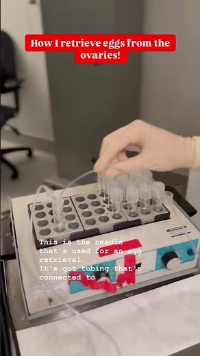How Eggs Are Collected During IVF (in vitro fertilisation)