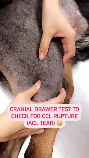 What we’re doing here is a Cranial Drawer Test to help diagnose a CCL Rupture (aka an ACL Tear) 😢🐶 This tests for the stability of the knee joint And the abnormal forward movement of the tibia (lower leg bone) in front of the femur (thigh bone) indicates laxity in the knee joint caused by a CCL rupture 😰 Save and share and follow along to learn with us! 🩺❤️ #veterinarian #veterinariansoftiktok #veterinarianlife #veterinarylife #vetlife #vetmedlife #vetmed #veterinarymedicine #veterinarystude