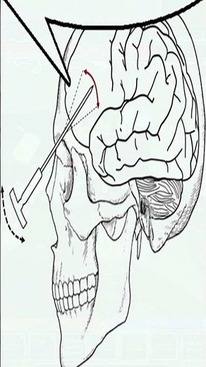 Mephisosceles Poise dmg build in Pilgrammed