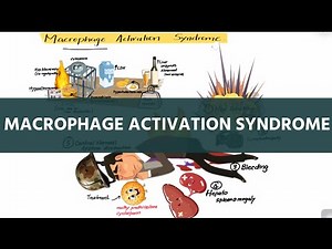 Macrophage activation syndrome