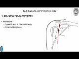 Scapula Fracctures • Video • MEDtube.net