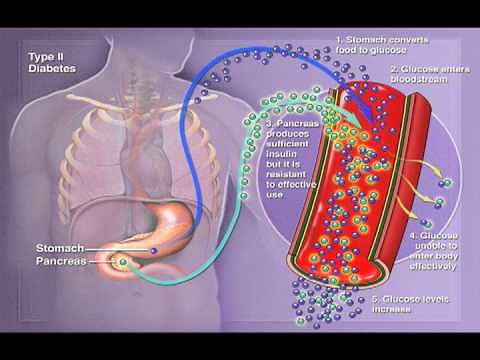 The Fig Tree "Mucus and You"