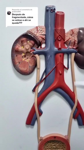 Litotripsia: Procedimiento de ureterolitotricia explicado por un experto