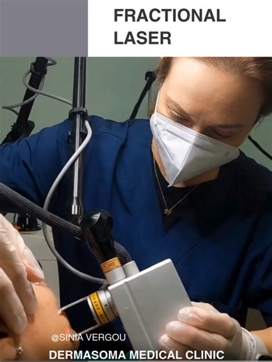 FRACTIONAL LASER : Θεραπεία για ουλές, ρυτίδες, ανάπλαση δέρματος 📌Η θεραπεία Fractional Laser CO2 εξασφαλίζει εντυπωσιακά αποτελέσματα στην ΑΝΑΠΛΑΣΗ, ΑΝΑΖΩΟΓΟΝΗΣΗ και την ΑΝΤΙΓΗΡΑΝΣΗ του δέρματος . . . 📌 Οι ακτίνες του laser, κάνουν επιλεκτική σάρωση όλης της επιφάνειας της επιδερμίδας, δρουν στα βαθύτερα στρώματα του δέρματος διεγείροντας τους ινοβλάστες, βοηθώντας έτσι στην παραγωγή κολλαγόνου και ελαστίνης. ✔ Ενδείκνυται για : • πανάδες • δυσχρωμίες • ουλές από ακμή • ρυτίδες • χαλάρωση • 