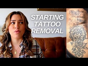 My Tattoo Removal at REMOVERY | Tattoo Removal Part 1