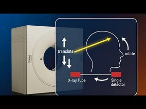 Generation of CT Scan, First generation of CT Scan, #radiology #ctscan #ctscanner #science #bsc #msc