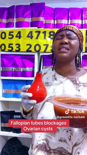 Fallopian Tubes Blockages and Ovarian Cysts Explained
