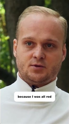 Elektroschock-Überlebender spricht offen über sein neues Aussehen