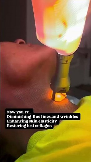 Erbium laser delivers controlled heat into the dermis to stimulate collagen production. #collagen