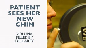 What Does She Think of Her "New" Chin? Nonsurgical Chin Augmentation