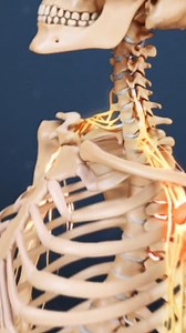 Need relief from neck pain after a car accident? In this video, we break down the symptoms, causes, and best treatments for whiplash injury — including exercises, stretches, and what to avoid. Whether you're dealing with neck stiffness, headaches, or shoulder pain, this guide will help you understand how to recover quickly and safely. | Spine-health