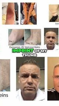 #6 Medical Miracle - Watch Eczema Vanish After One Shot!