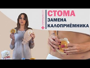 How to Replace a Two-Piece Ostomy Bag | Sterilno.com