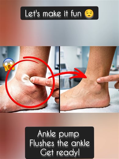 Ankle Pump Song: Flush Swollen Ankles Naturally
