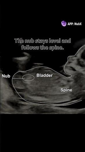 Learn your baby's gender for NubX!